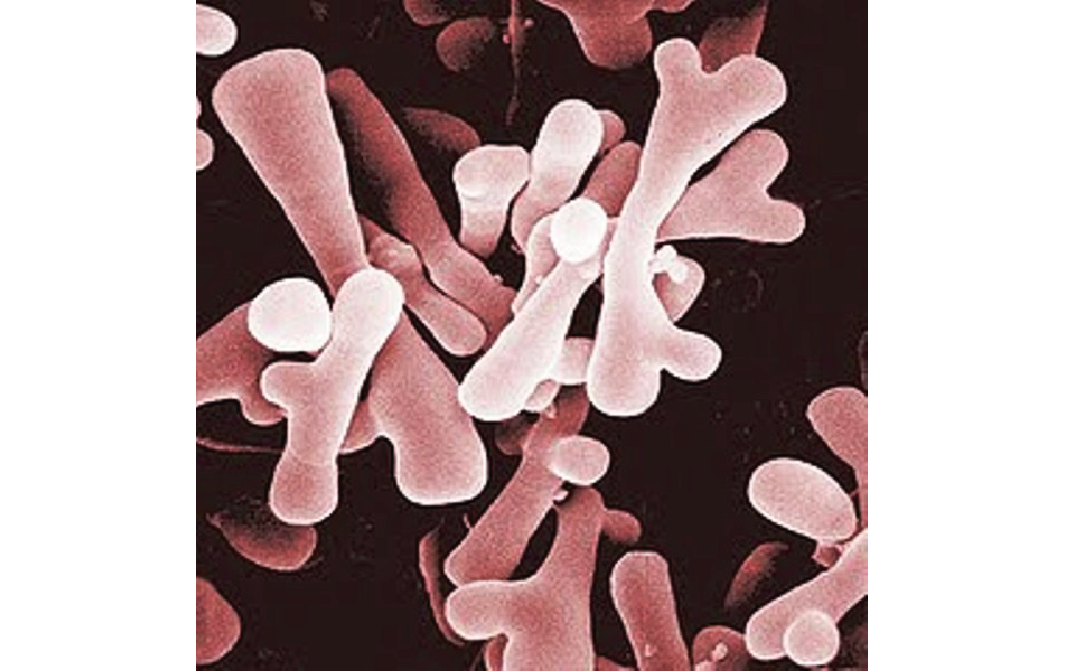 Бифидобактерии в кале. Бифидобактерии (bifidum adolescentis). Бифидум и лактобактерии. Bifidum бактерии. Бифидобактерии под микроскопом.